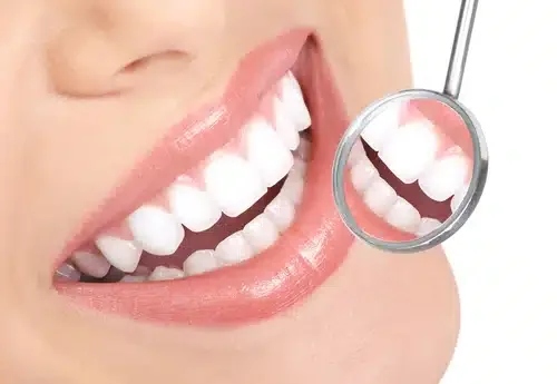 Laser Teeth Whitening